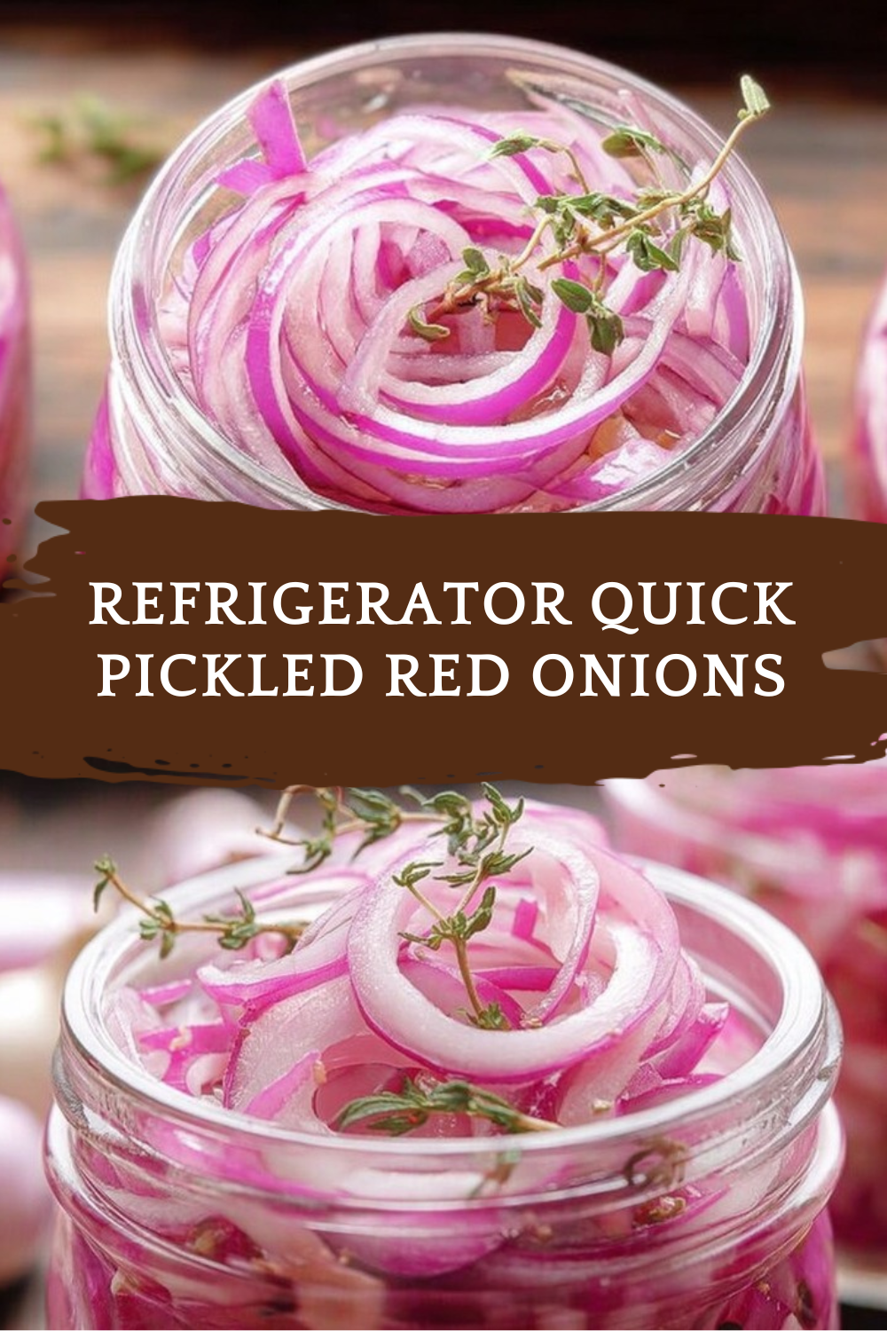 Refrigerator Quick Pickled Red Onions